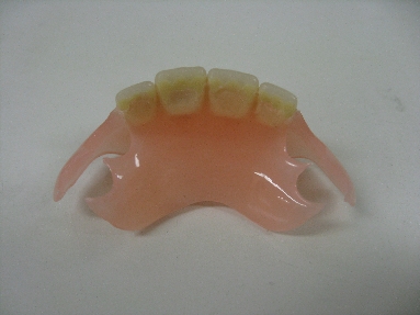 審美義歯２.JPG